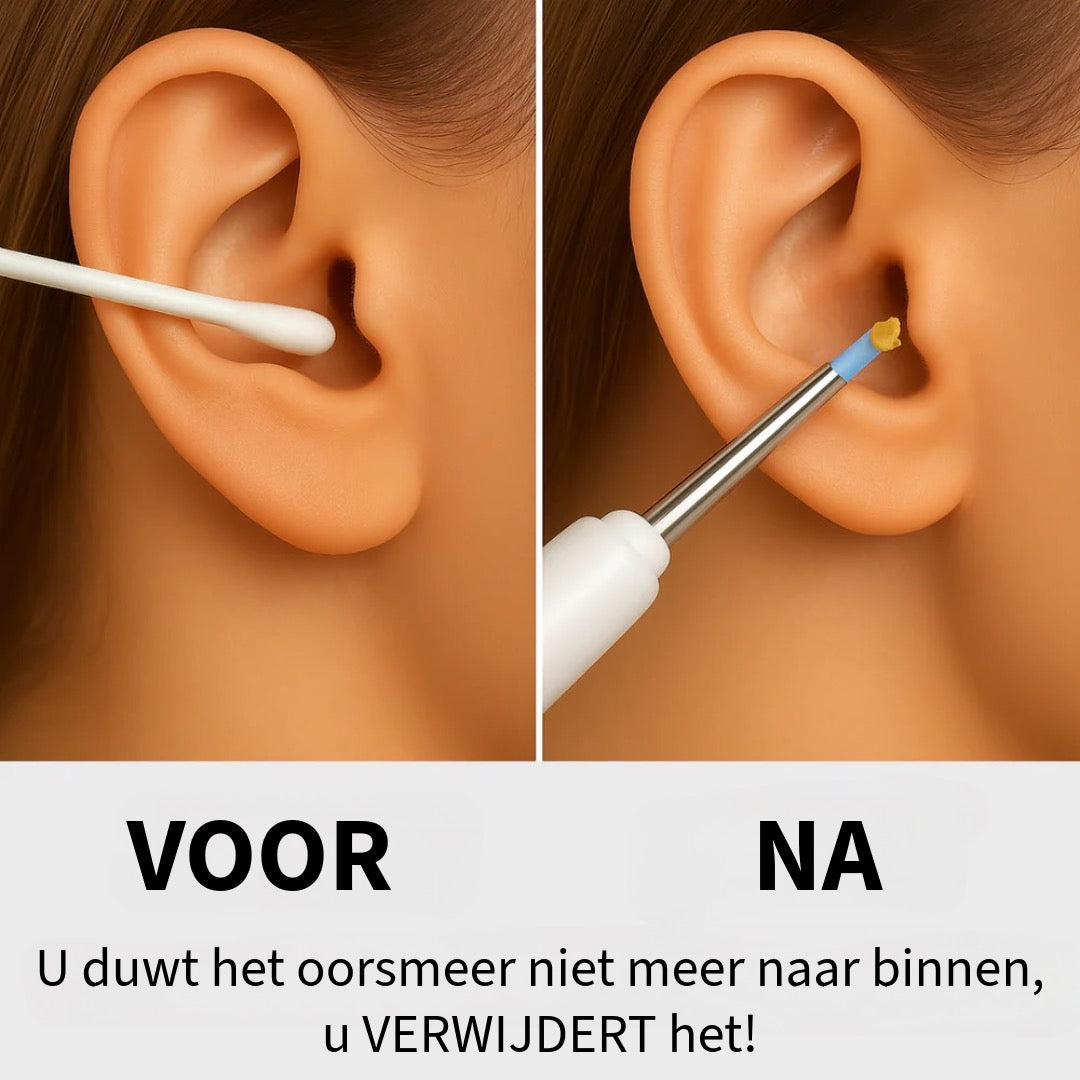 Professionele Digitale Oorsmeer verwijderaar