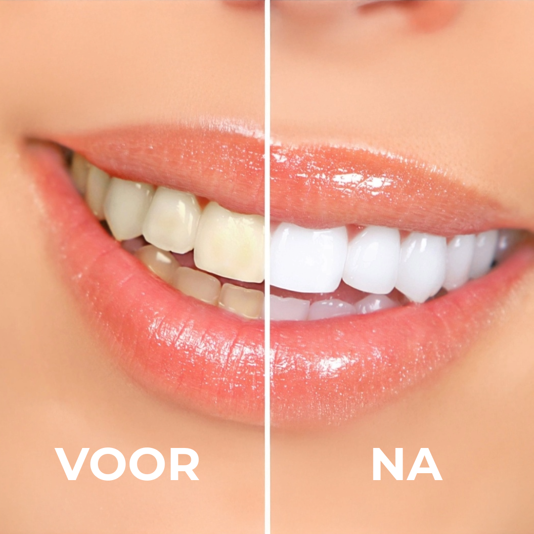 YouBuy™ | Professioneel Tanden Bleek Poeder