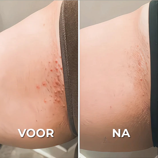 Professioneel Scheerapparaat
