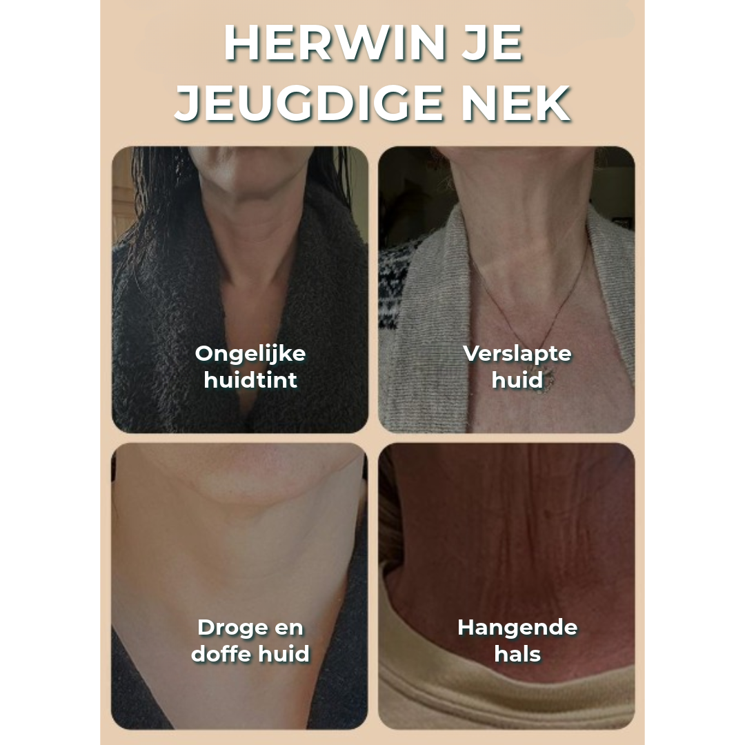 YCZ™ | Nekverstevigingscrème