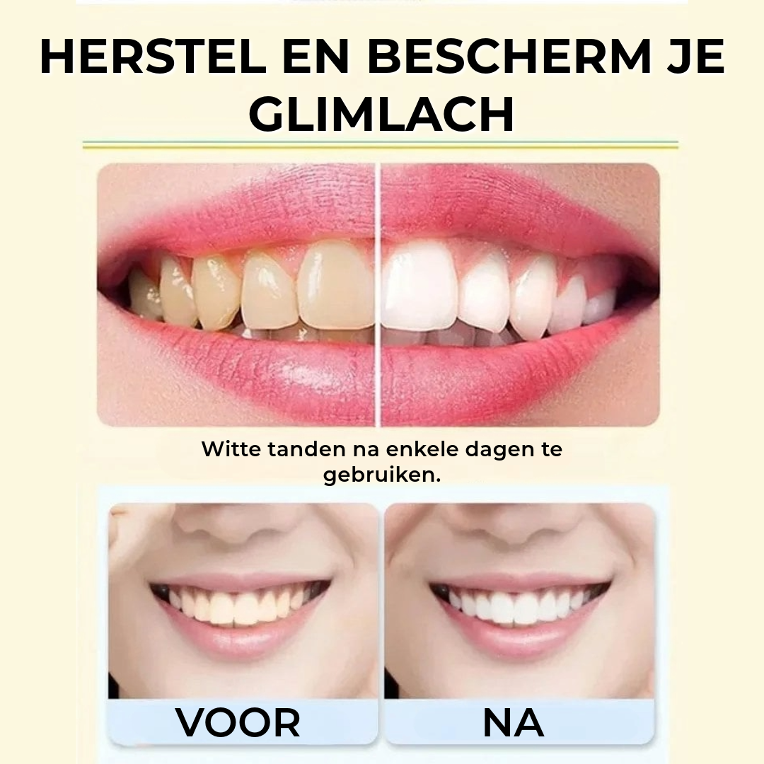 Probiotische Tandpasta