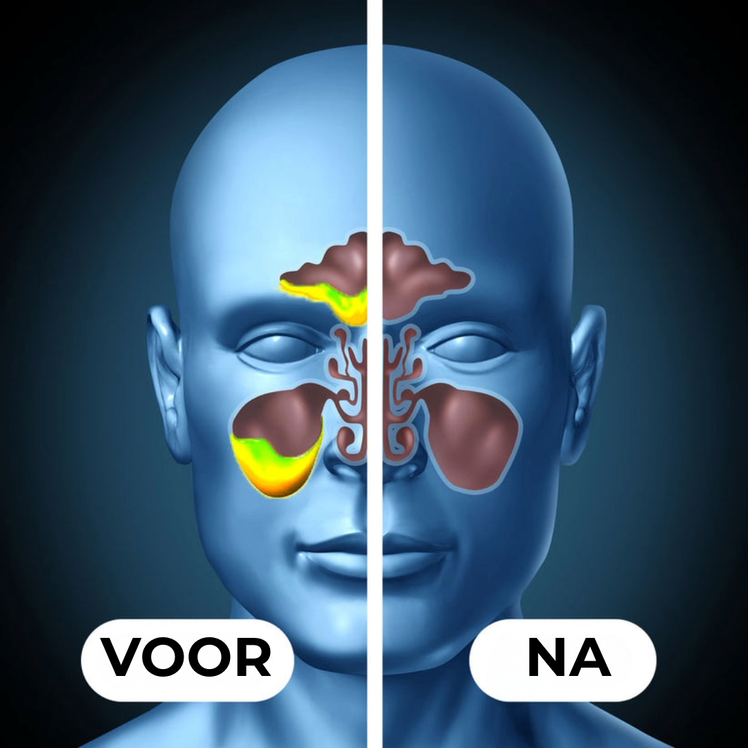 Professionele Sinus Reiniger