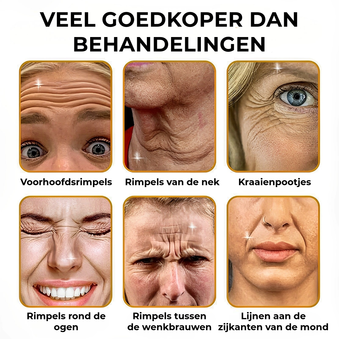 BOTOX™ Anti-Rimpelcrème