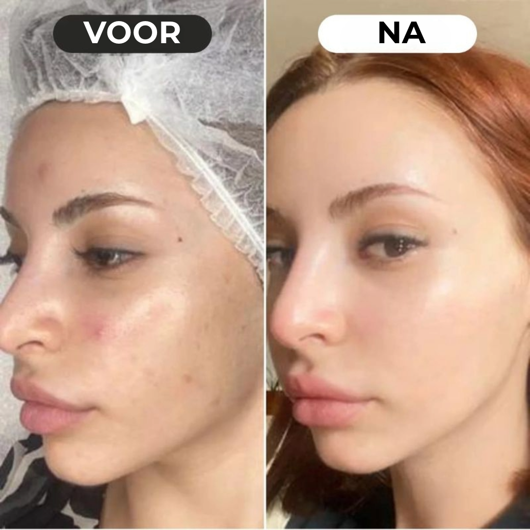 Lumeor™ Collageen Masker