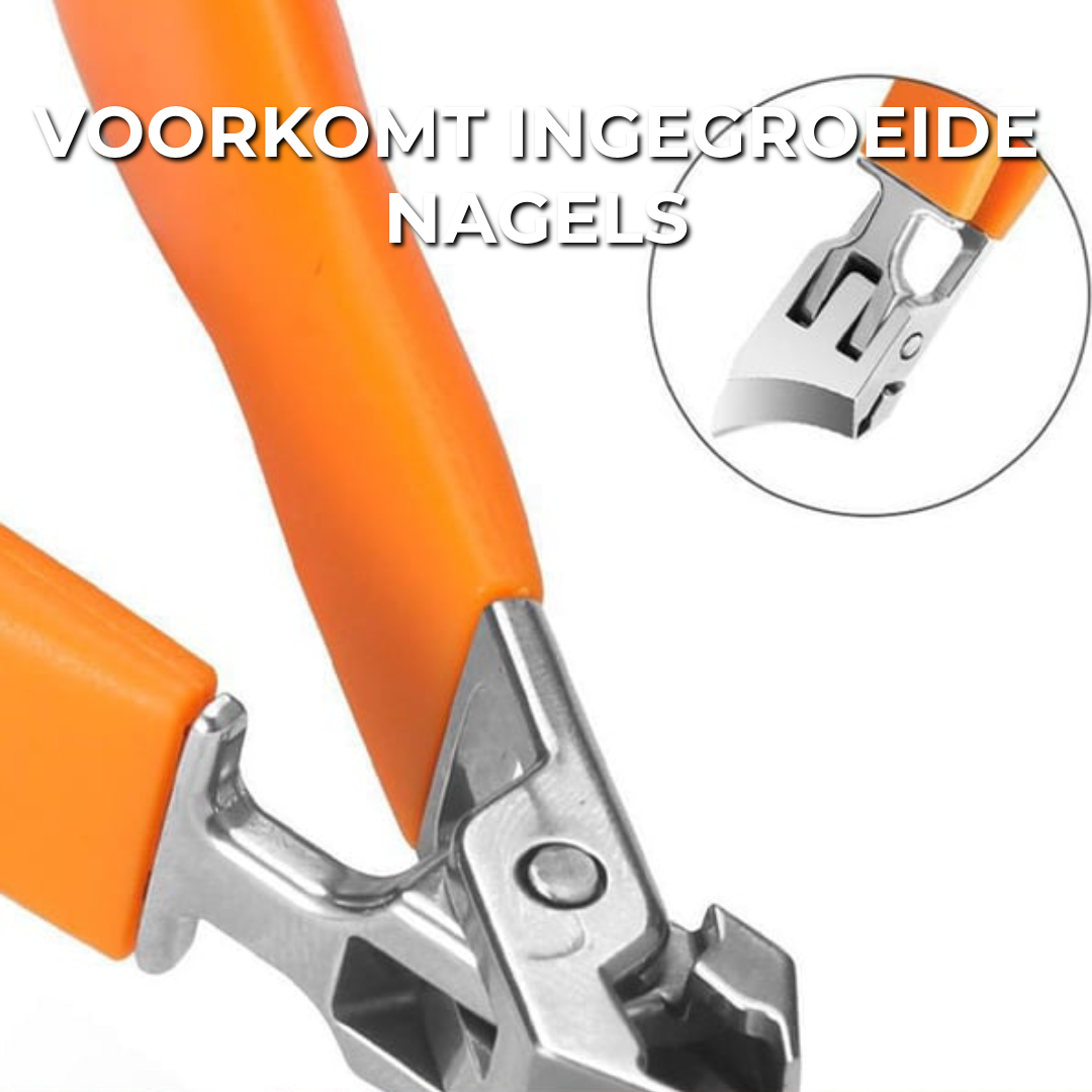 Anti-Nagel-Ingroei Knipper