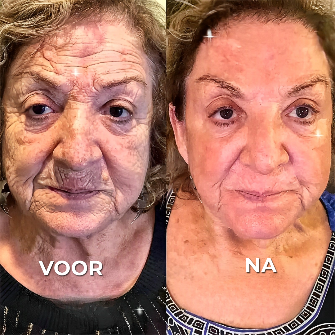 BOTOX™ Anti-Rimpelcrème