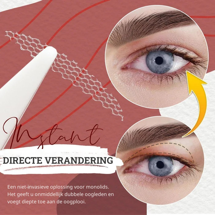 EyeLift™ Strips