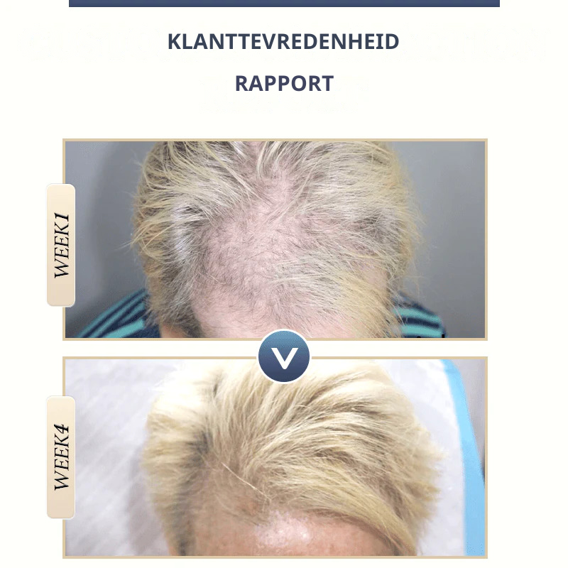 OriginGROWTH™ | Anit-haar verlies Shampoo