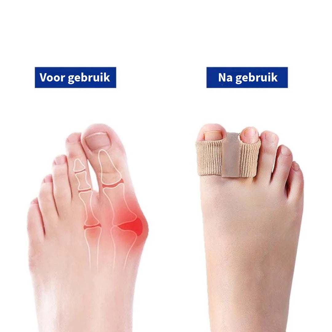 Elastische Tenen Spreiders