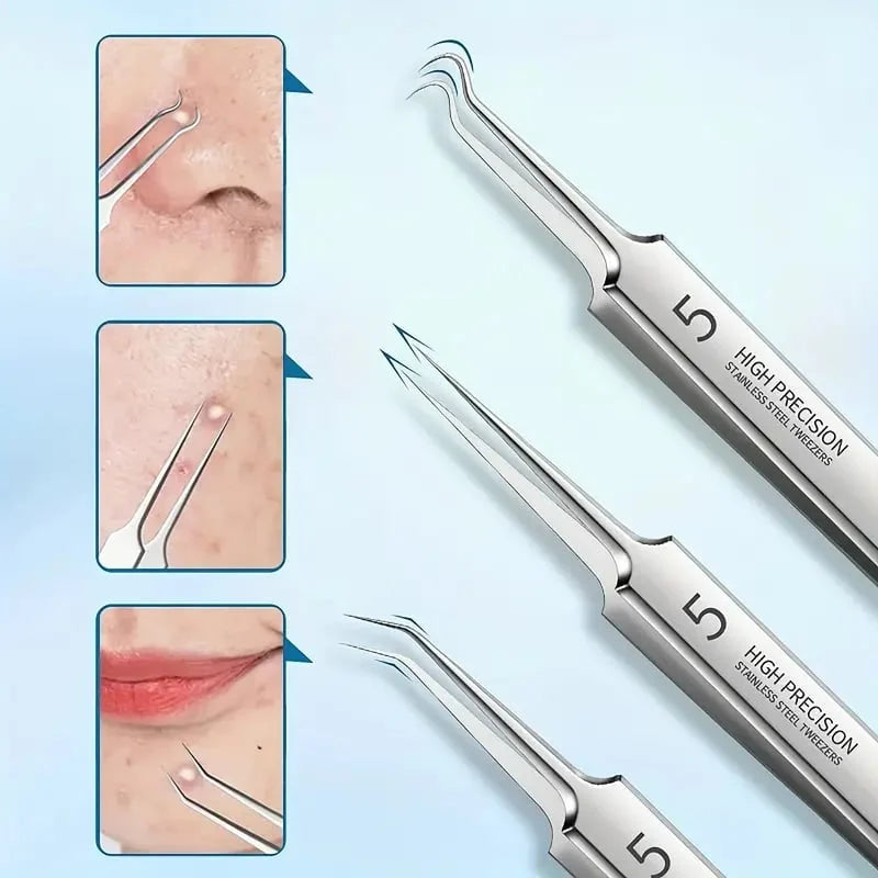 PrecisionTweez™ - Professionele blackhead remover