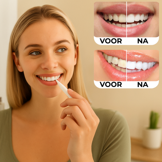 Professionele Tandenbleekstick