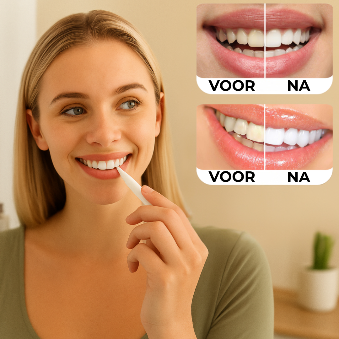 Professionele Tandenbleekstick