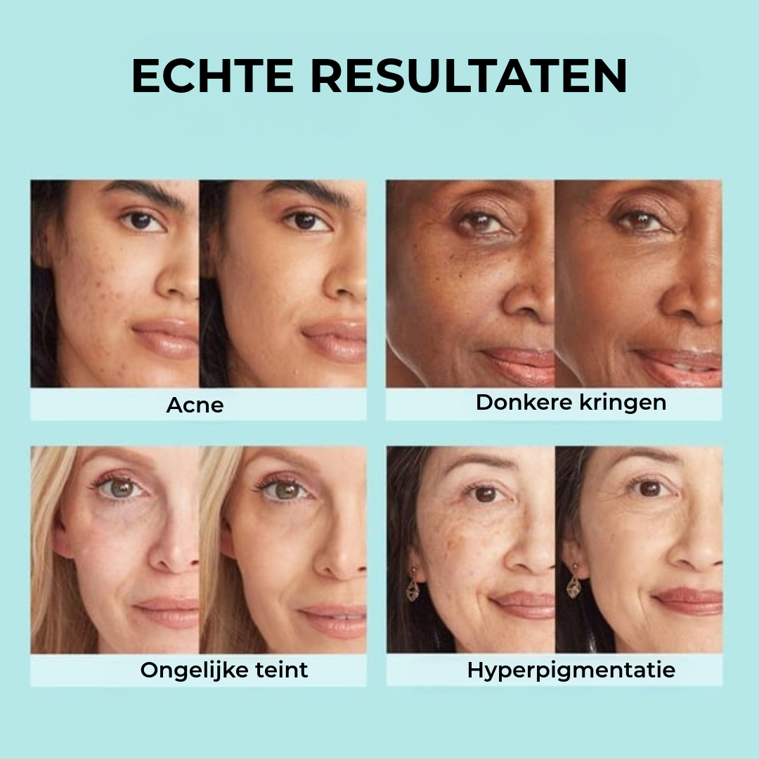 3-in-1 Crème – Dagcrème, Concealer & Foundation in Eén