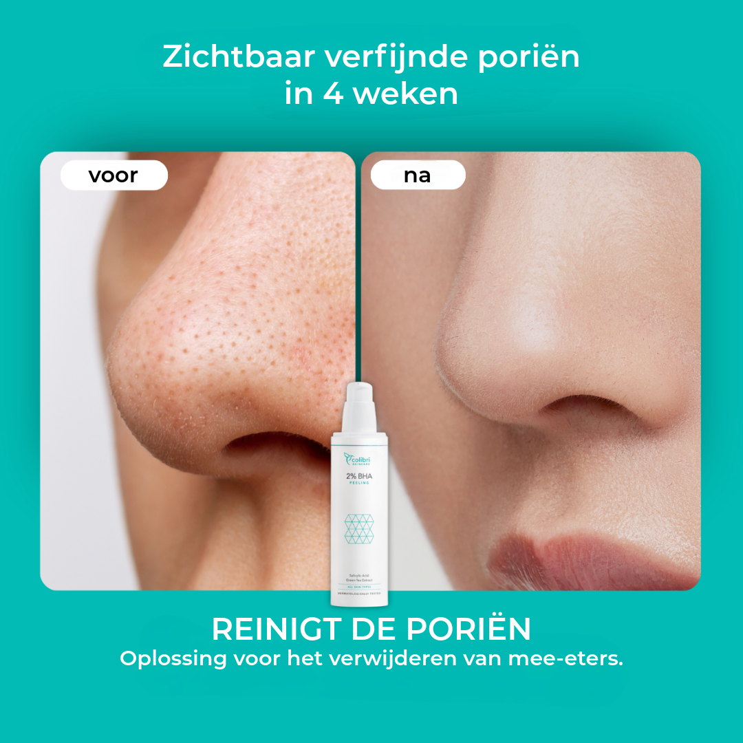 BHA Anti-Acne Masker