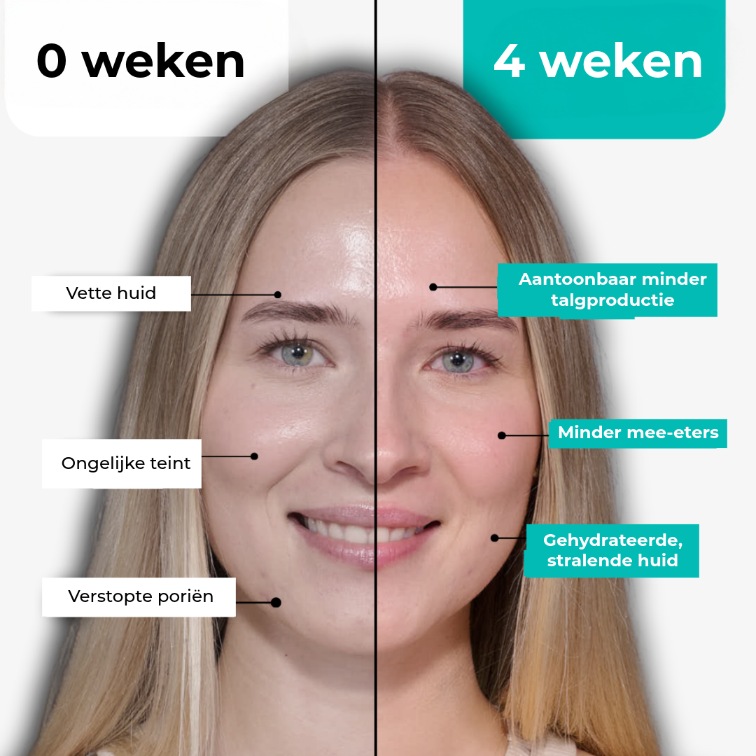 BHA Anti-Acne Masker