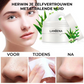 LANBENA™  Blackhead Gezichtsmasker 60 Stuks