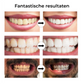 Professionele Tandenbleekstick