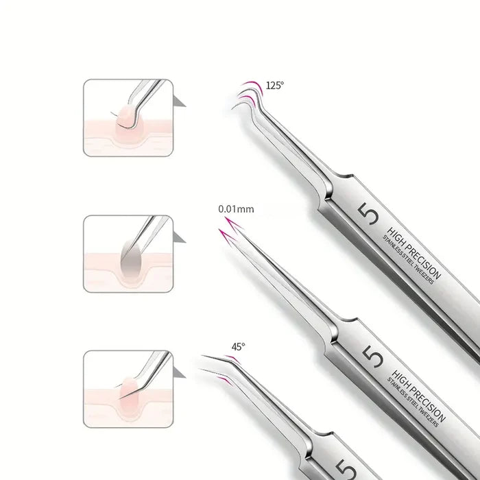 PrecisionTweez™ - Professionele blackhead remover